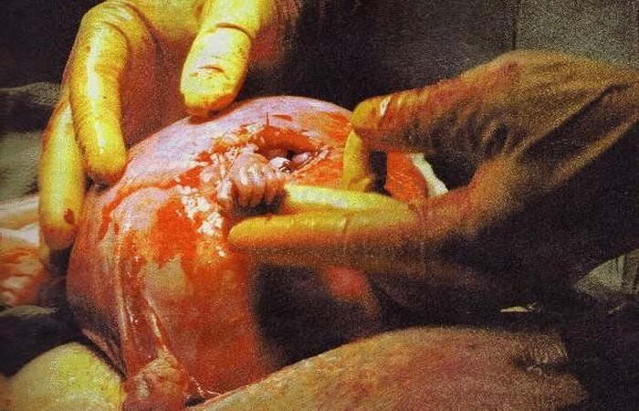 Рука надії… Те що зробив хірург, щоб врятувати немовля просто неймовірно (ФОТО)