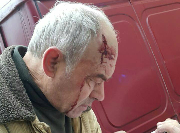 Во Львове водитель авто избил дворника обоями (ФОТО)