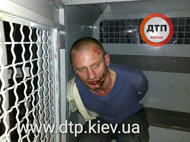 Не на того напали: Господар будинку під Києвом побив нічних злодіїв і передав поліції (фотофакт)