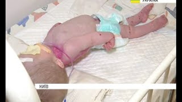 Шокуюча безсердечність: у київській лікарні знайшли занедбану лікарями однорічну сироту (відео)