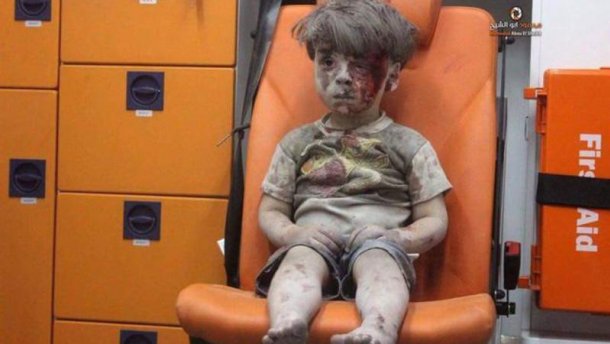 У Сирії помер брат хлопчика, фото якого шокувало світ
