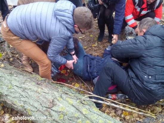 Це щось жахливе: комунальники рубали дерево і покалічили ноги дівчинці (ФОТО)