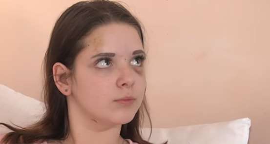 Жорстоко побита школярка з Чернігова вразила мережу своїми намірами на майбутнє