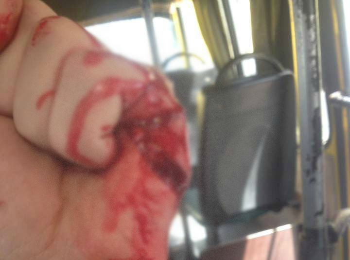 ТЕРМІНОВО! У Києві водій маршрутки жорстоко поранив бійця АТО ножем! Деталі просто збивають з ніг (ФОТО)