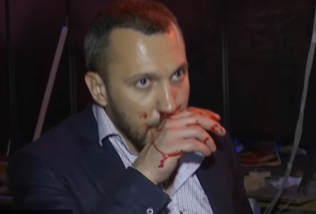 Розбитий ніс і швидка допомога: У прямому ефірі українського телеканалу депутати влаштували справжній мордобій