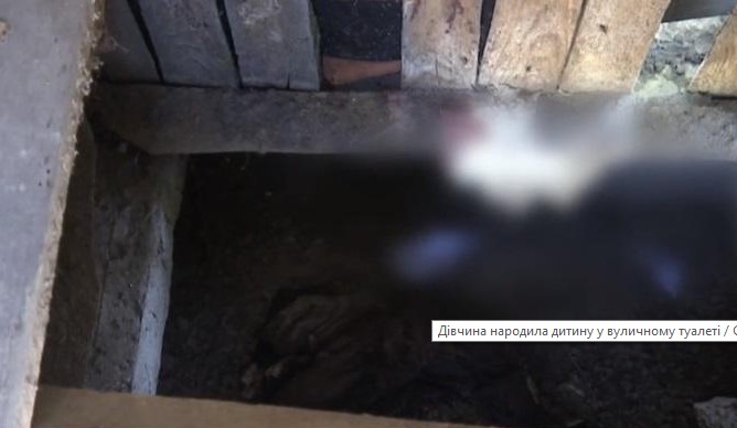 “Немовля впало просто у яму”: Екстремальні пологи на Херсонщині: 17-річна дівчина народила просто у туалеті