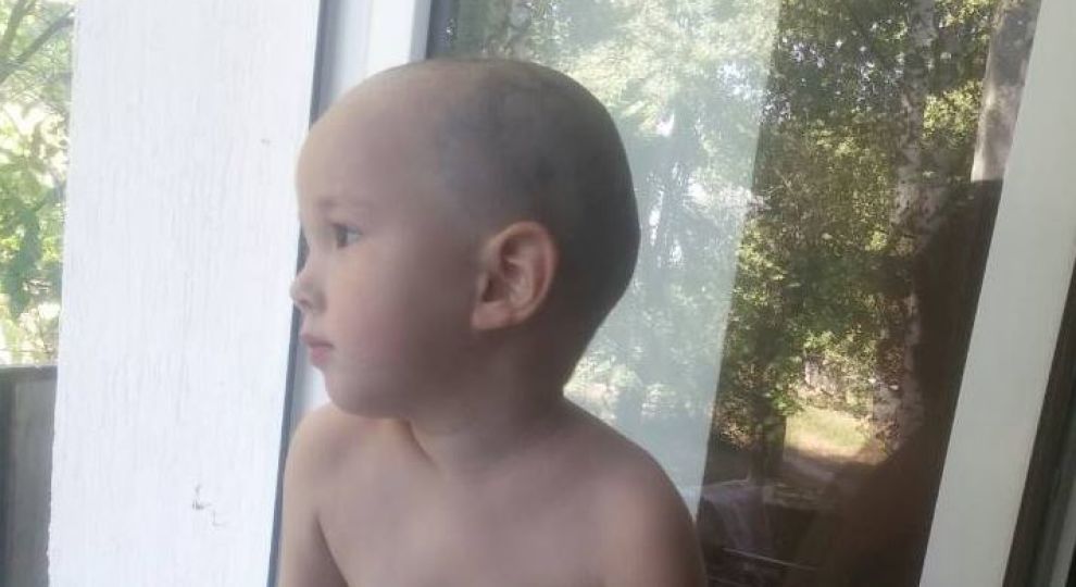 Побічні дії хіміотерапії вражали найважливіші органи: маленькому Адаму потрібна ваша допомога
