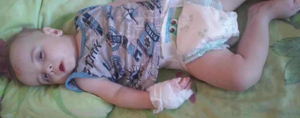 Малюк у важкому стані в лікарні: Маленькому Матвійку дуже потрібна ваша допомога