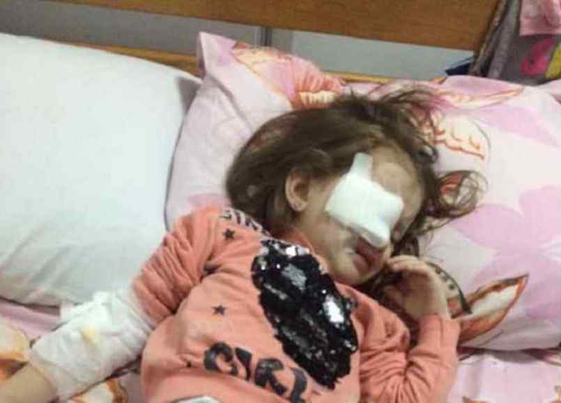 Назріває новий скандал: під час бійки в дитсадку в Дніпрі дівчинці проткнули око олівцем
