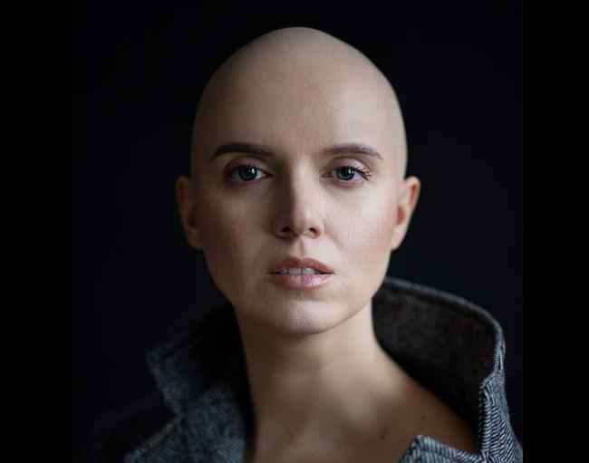 “7 місяців тому я дізналася, що у мене рак”: Яніна Соколова зробила відверте зізнання
