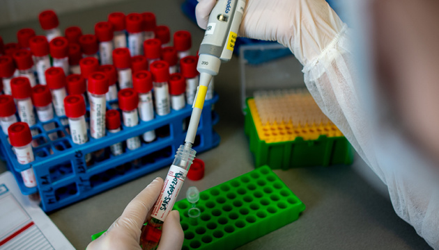 В Україні офіційно 475 випадків коронавірусу. Збільшилась кількість летальних випадків