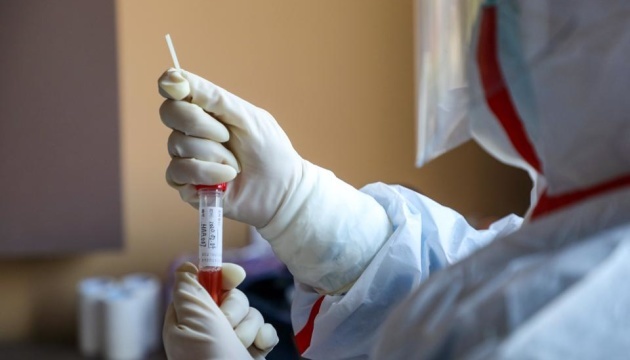 За добу 62 нових випадків! Ситуація з коронавірусом в Україні погіршується. 11 летальних