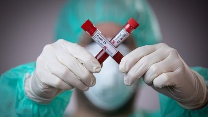 Загалом 708 летальних! В Україні знову зросла кількість хворих на коронавірус. Оперативна інформація
