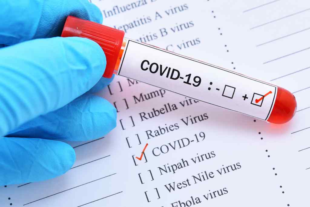 Понад півтисячі нових випадків. Оновлена статистика по коронавірусу: Лідирує Чернівецька область