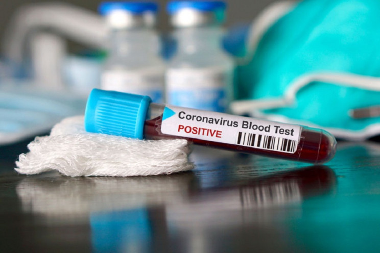 Хороша новина! Кількість хворих на коронавірус на Львівщині. Тенденція на зменшення