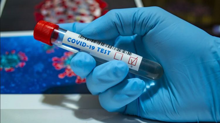 17 летальних випадків за добу! В Україні знову зростає кількість хворих на коронавірус. Більше 20 тисяч випадків