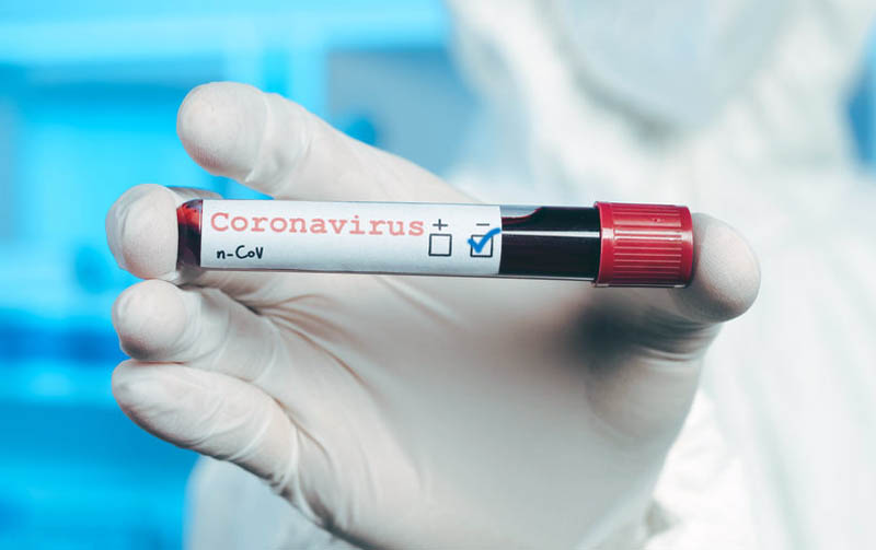 Найбільше з початку карантину! В Україні більше 30 тисяч випадків коронавірусу. За останню добу сумний антирекорд!