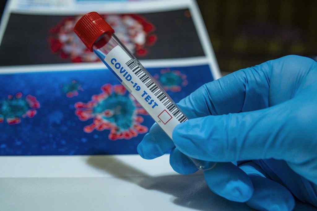 Хороша новина! Ситуація з коронавірусом в Україні за минулу добу – нових випадків менше