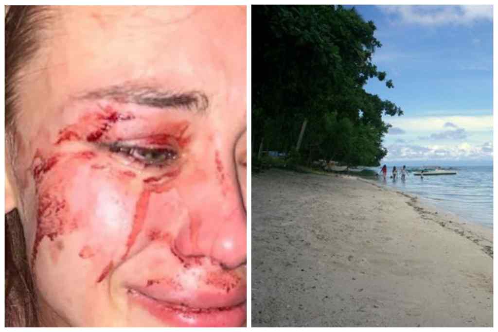 “Прямо на пляжі”: Відому українську модель жорстоко побили в Туреччині. “Не хочу мовчати”