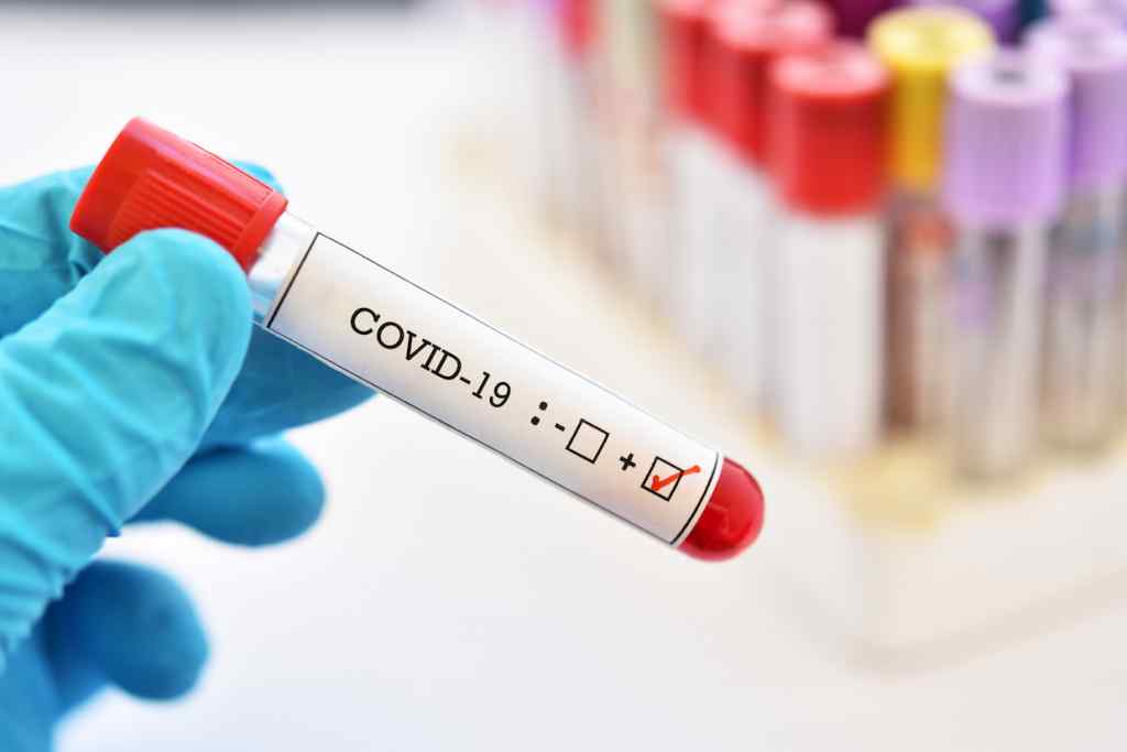 Пішов на спад! Оновлена статистика по коронавірусу в Україні. Найбільше випадків на Буковині