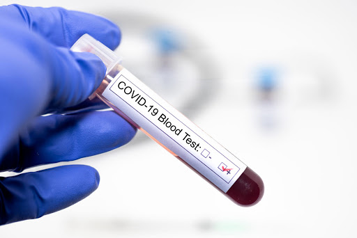 Після антирекорду. Кількість нових інфікувань коронавірусом різко зменшилася: десятки померлих на добу