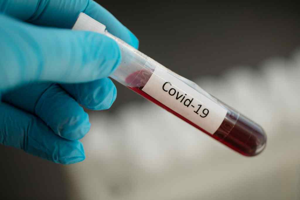 Після локдауну! Оновлена статистика по коронавірусу в Україні. Мінімальна кількість нових хворих